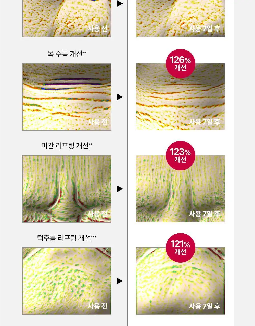 [윤곽앰플] 메디톡스 뉴라덤 코어타임 앰플 2개입 상세페이지 26